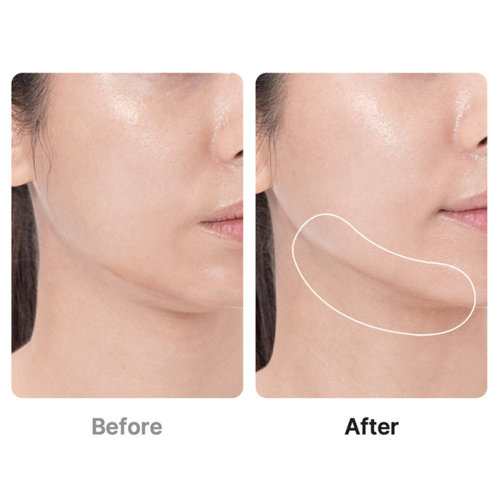 AGE-R Booster Pro - GLAM MODA