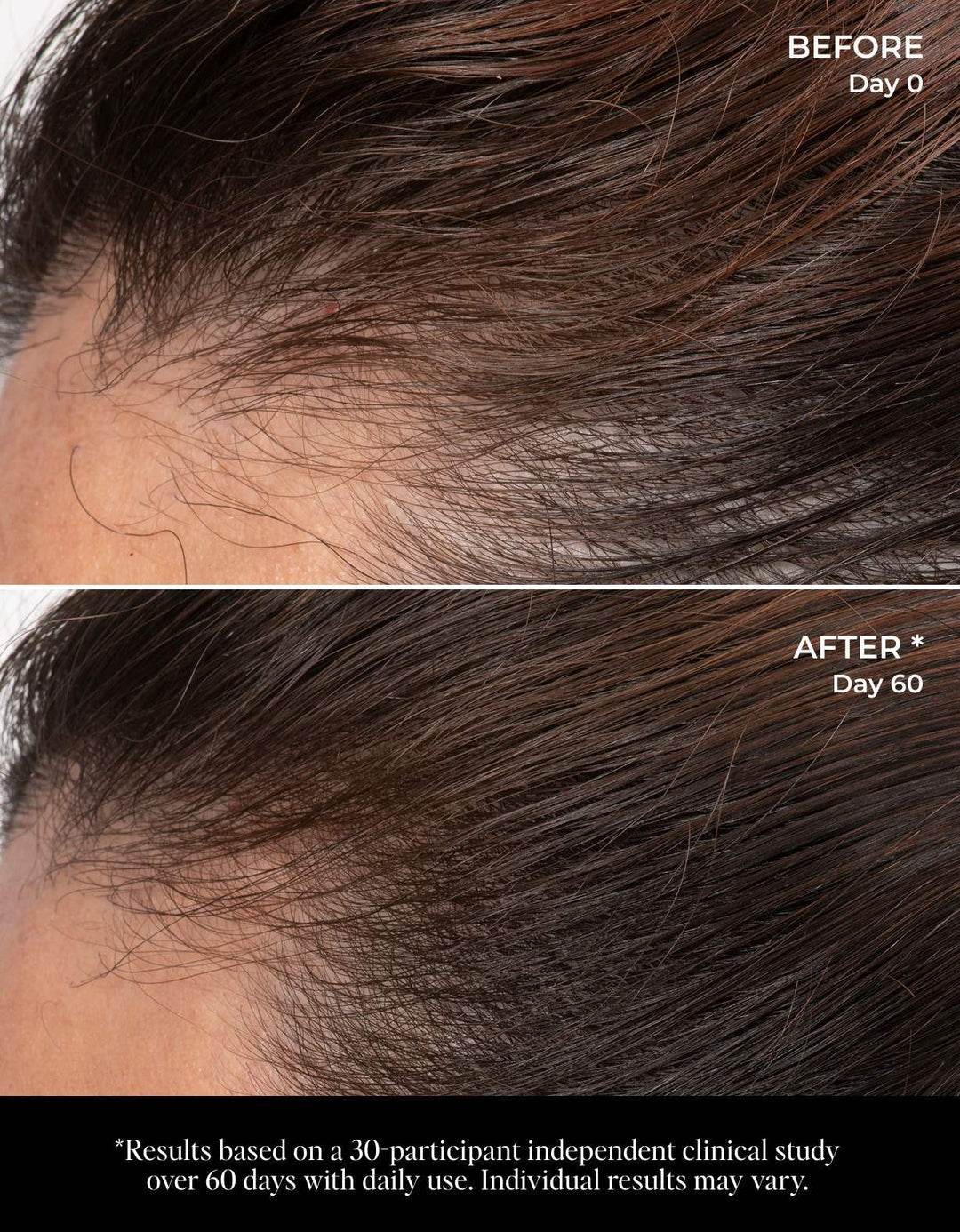 Let There Be Hair Scalp Serum - GLAM MODA