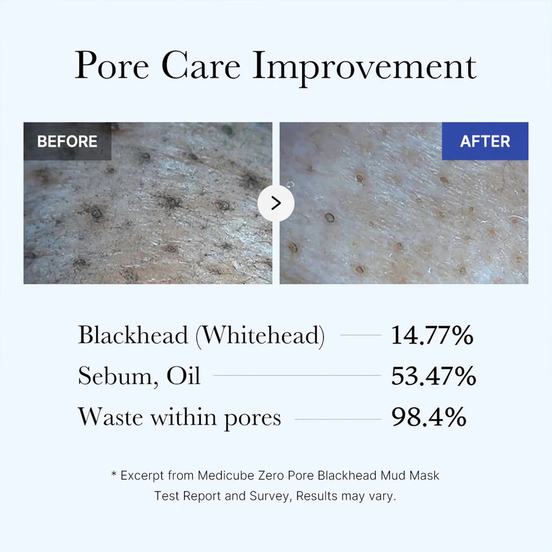 Zero Pore Blackhead Mud Mask - GLAM MODA