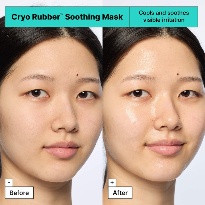Cryo Rubber™ Soothing Face Mask with Allantoin - GLAM MODA
