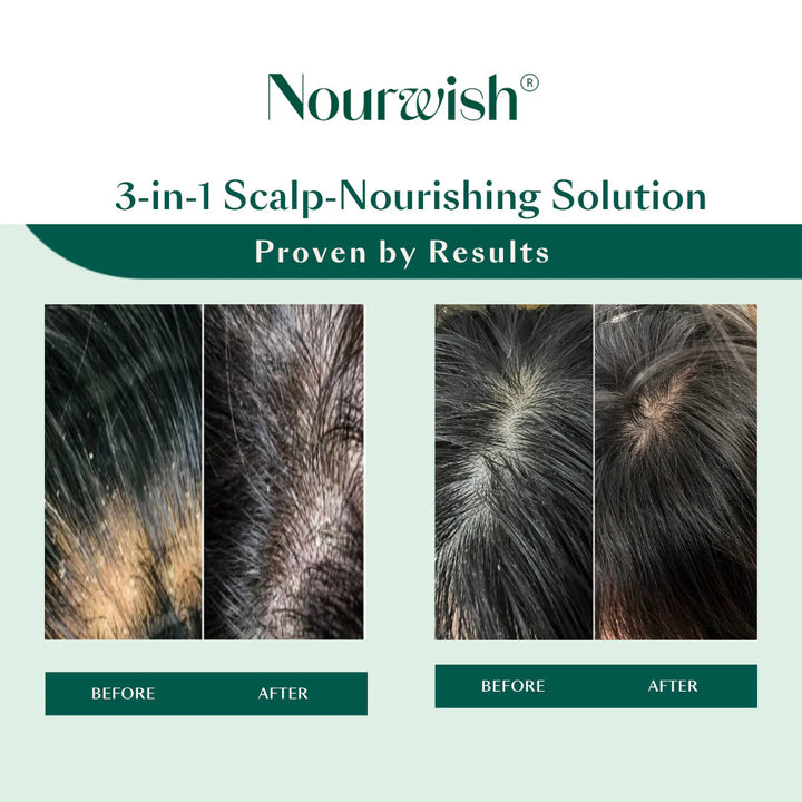 Nourwish Scalp Retreat Nourishing Scalp Serum - GLAM MODA
