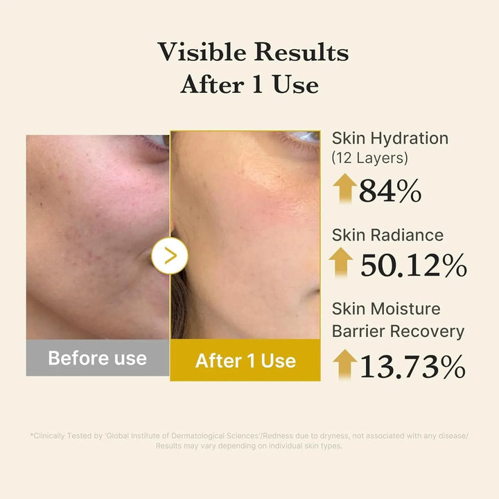 Kojic Acid Turmeric Vita Jelly Mist Serum - GLAM MODA