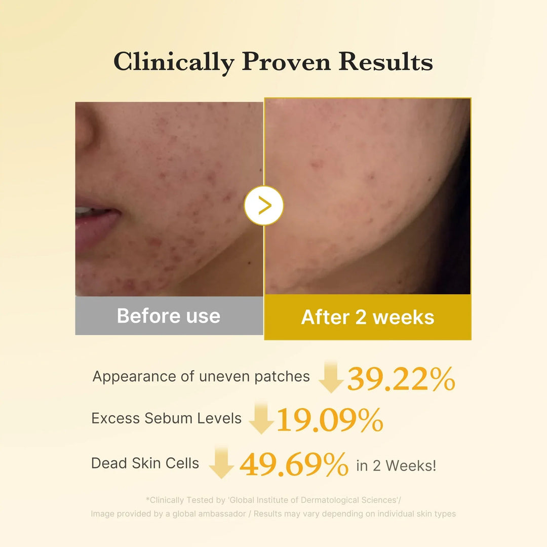 Kojic Acid Tumeric Toner Pad - GLAM MODA