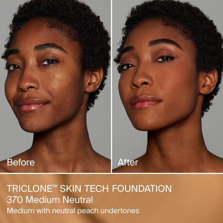 370 Medium Neutral - Triclone™ Skin Tech Medium Coverage Foundation - GLAM MODA