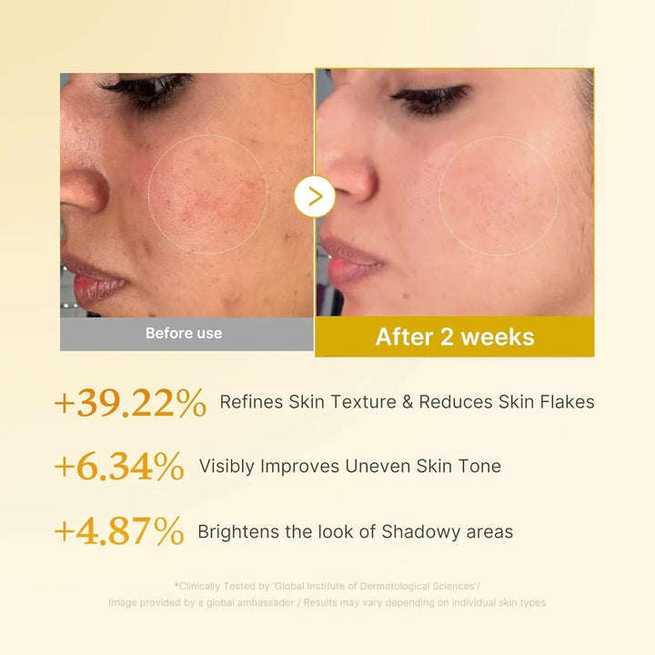 Kojic Acid Turmeric Toner - GLAM MODA