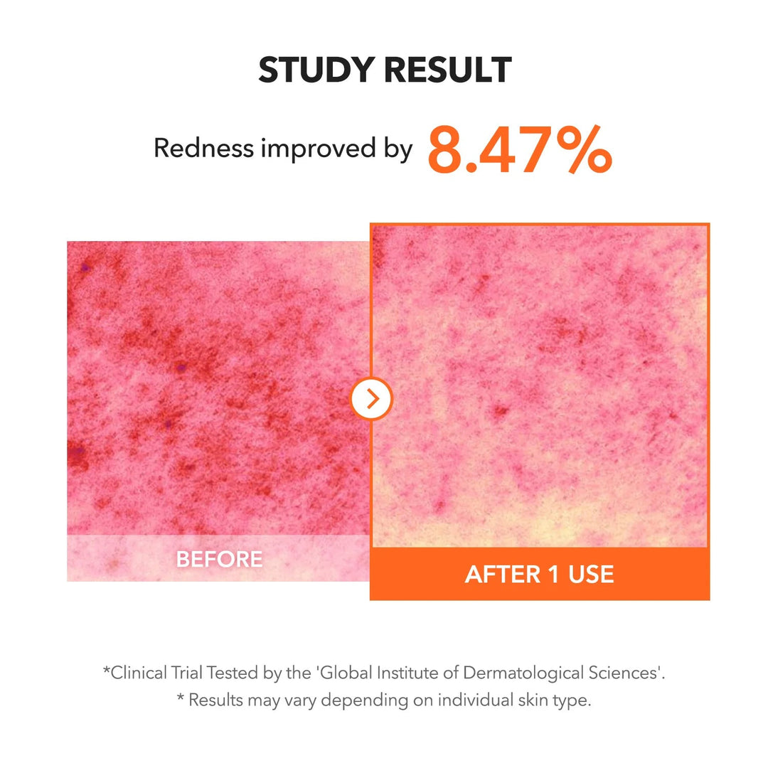 Carrotene IPMP™ Clearing Solution - GLAM MODA