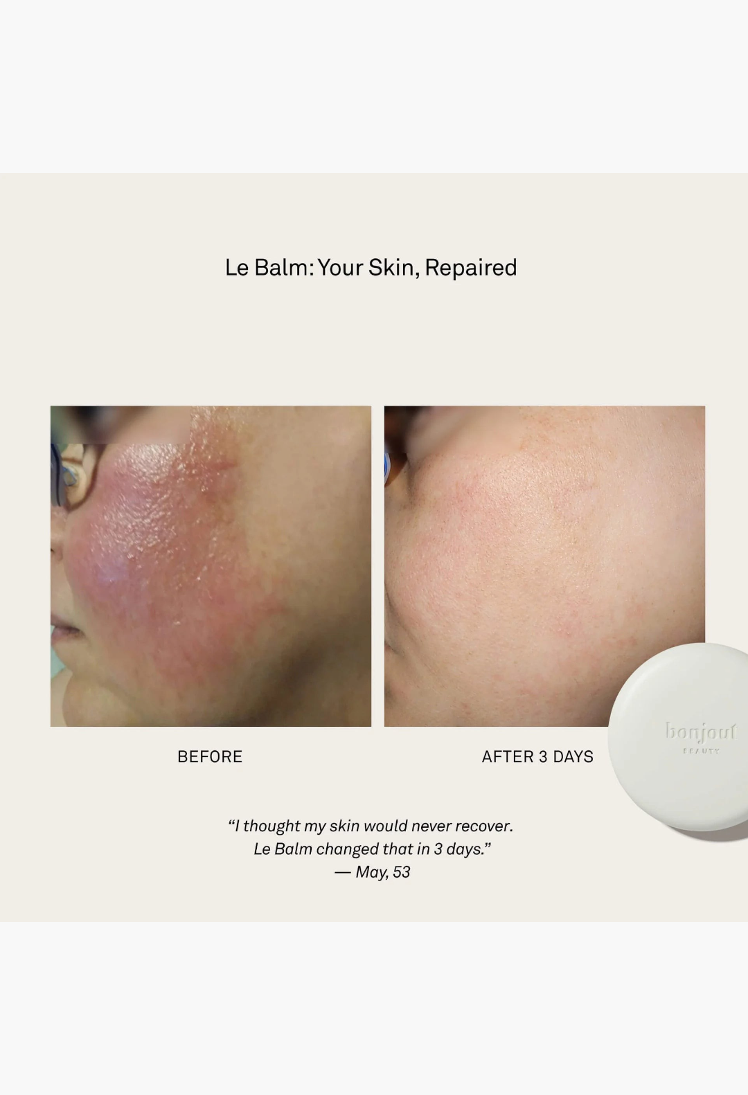 GLAM MODA before and after comparison showing skin barrier repair and soothing results from Bonjout Le Balm treatment