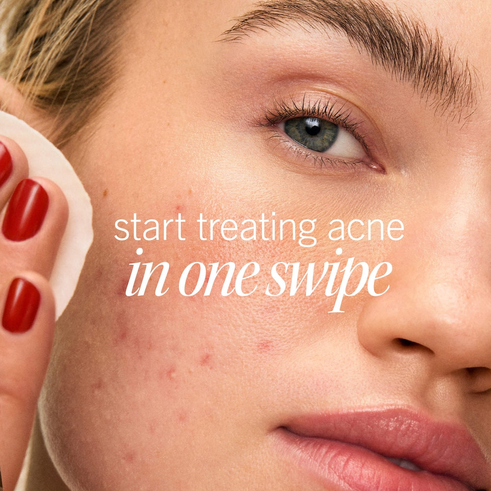 Acne Clearing Pads - 2% Salicylic Acid Acne Treatment - GLAM MODA