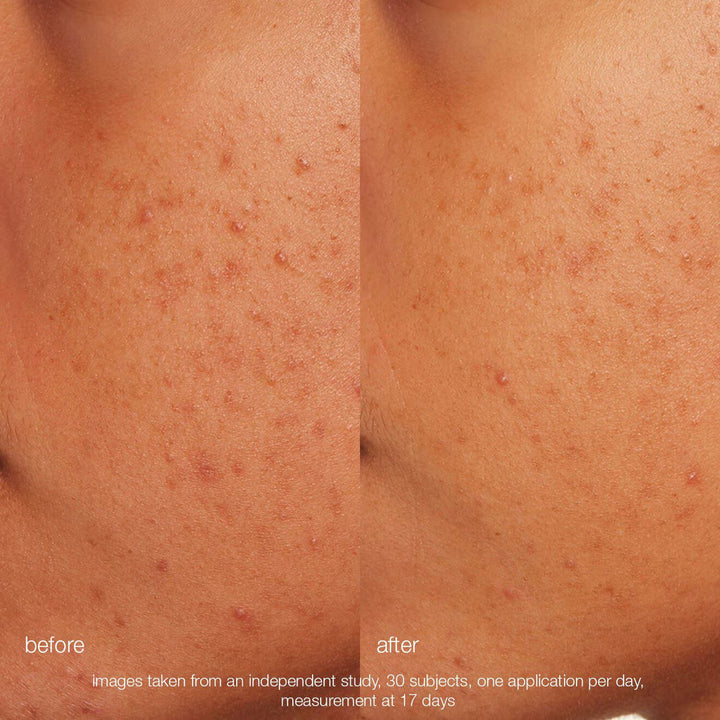 Daily Microfoliant Exfoliator - GLAM MODA