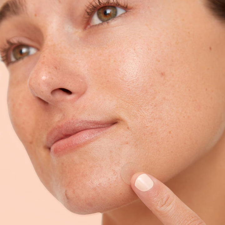 Acne Dots - Acne Healing Dots - GLAM MODA