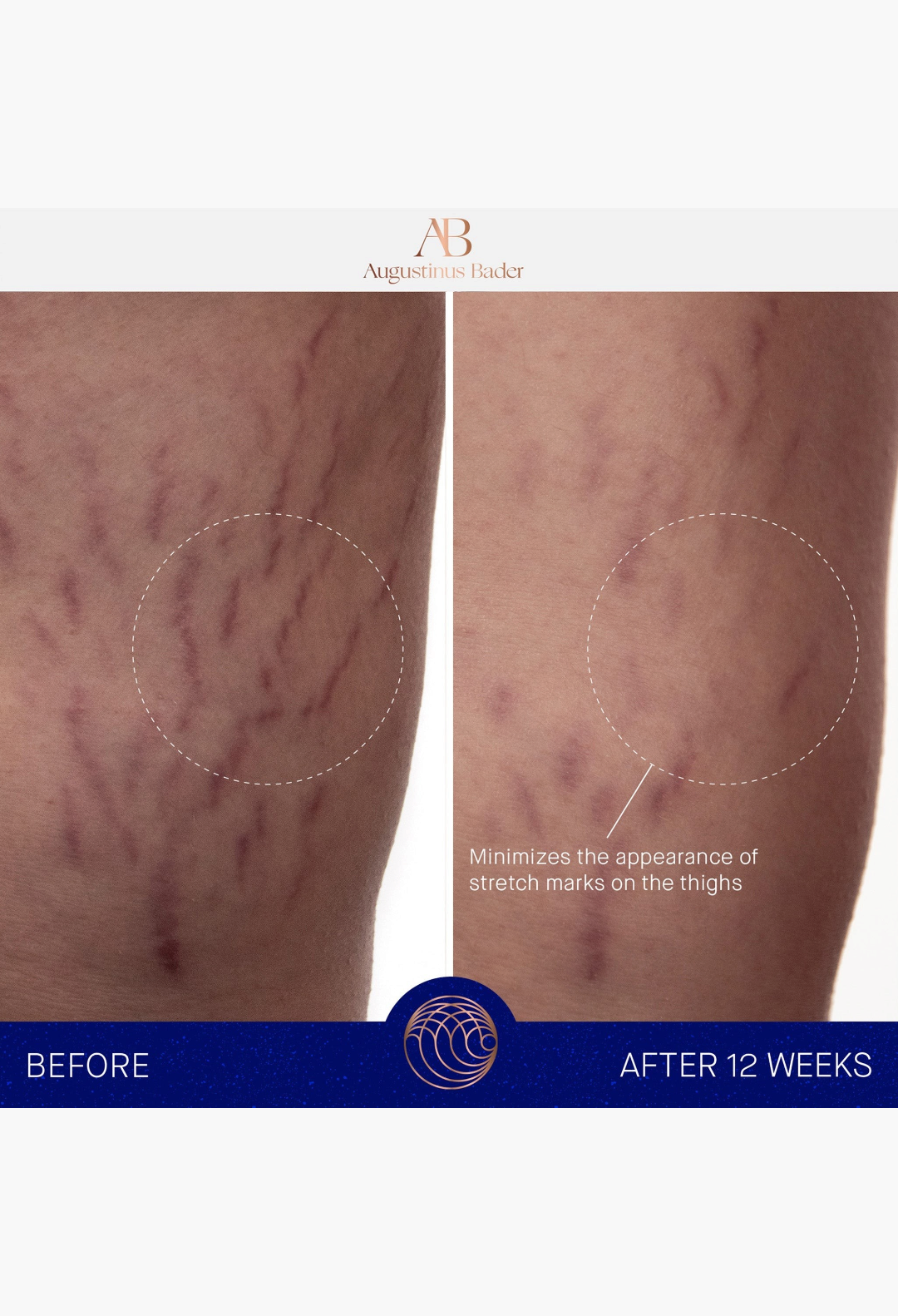 Augustinus Bader THE BODY CREAM