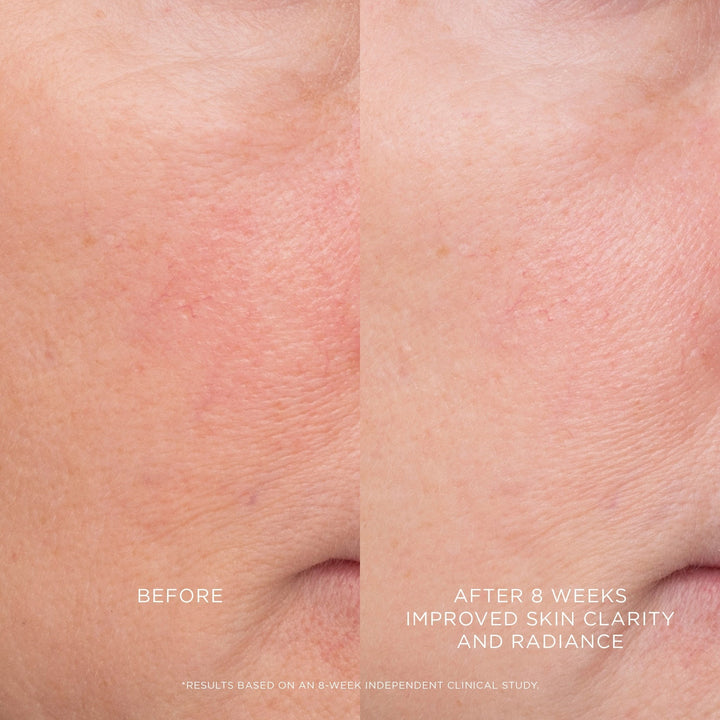 Equilibrium Resurfacing Retinoid Treatment - GLAM MODA