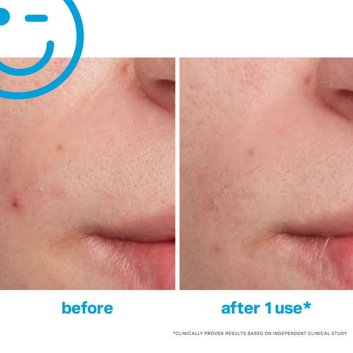 EradiKate Blemish Treatment 30ml - GLAM MODA