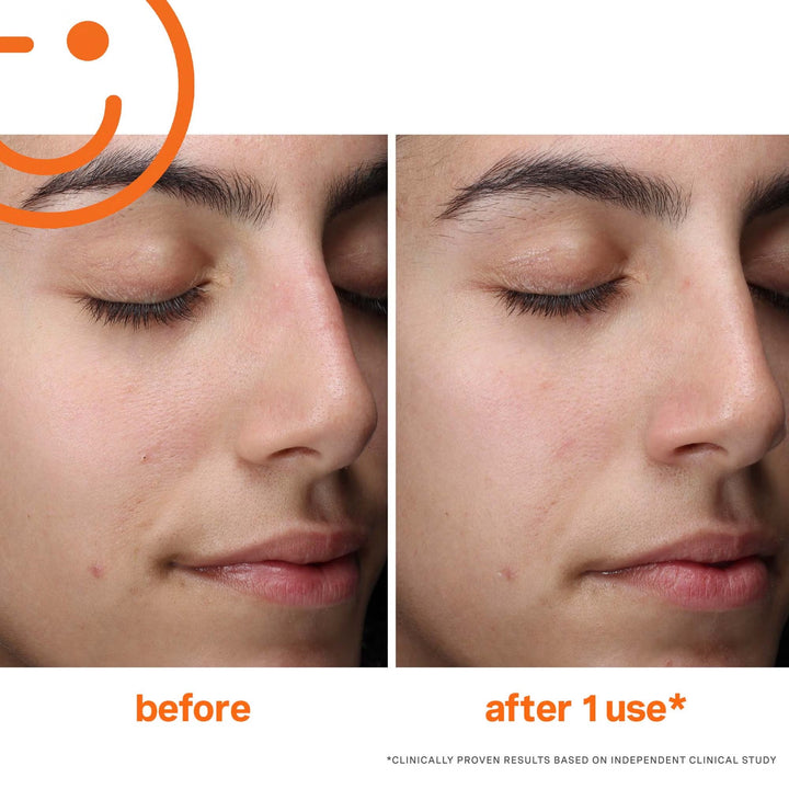 ExfoliKate Cleanser Daily Foaming Wash - GLAM MODA