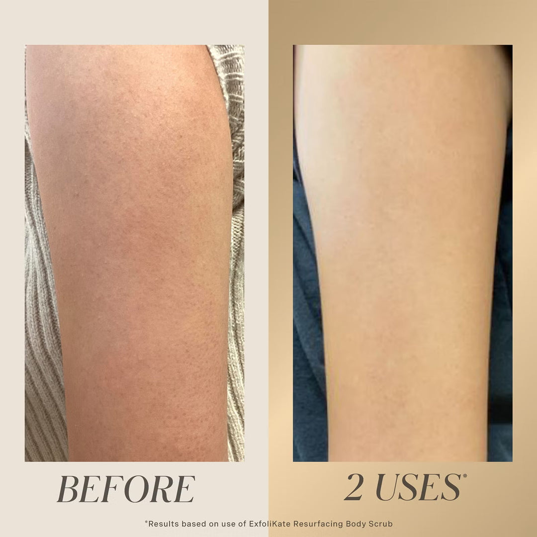 Exfolikate Resurfacing Body Scrub 150ml - GLAM MODA
