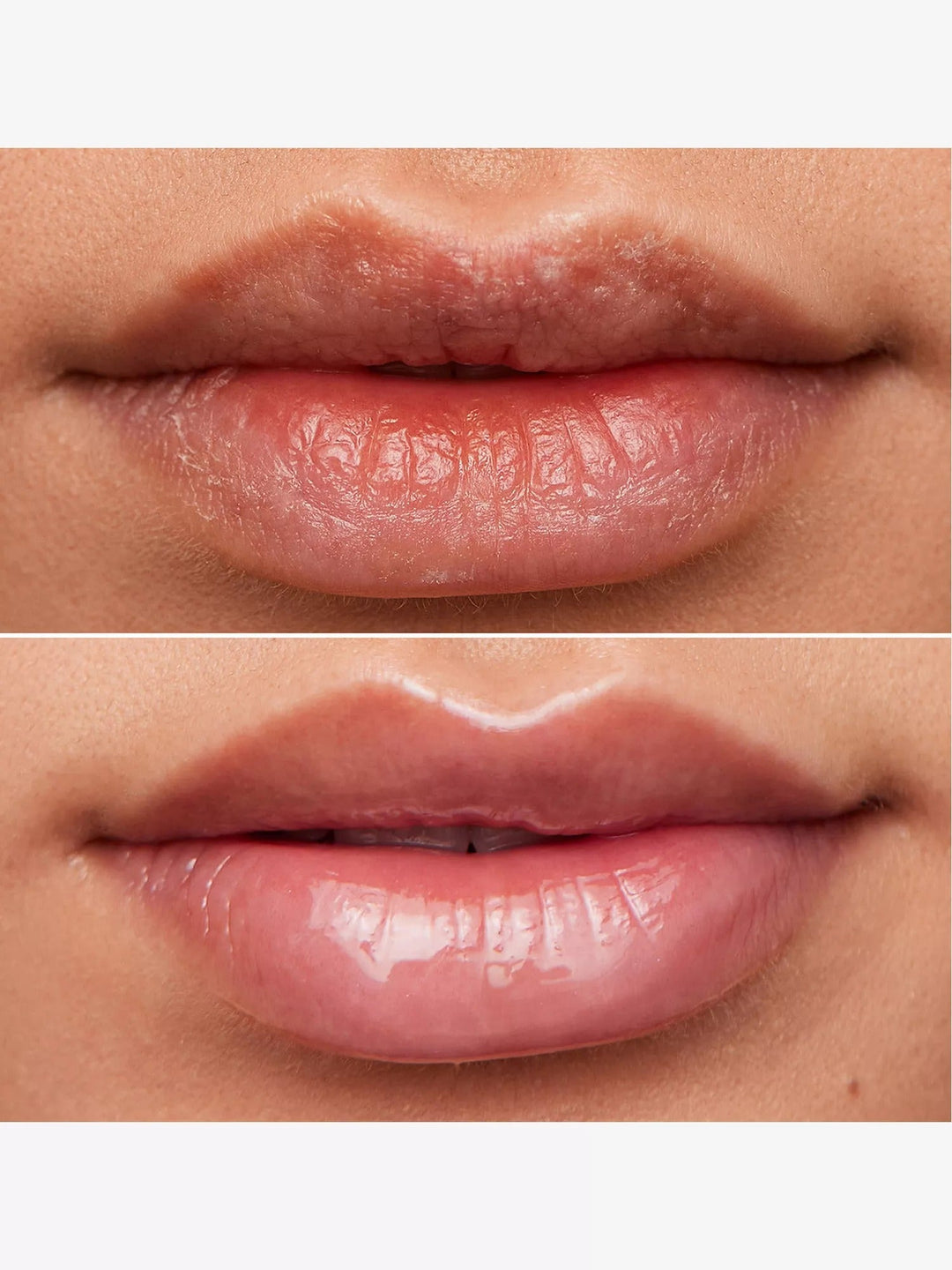 Lip Rehab Serum Oil 3.57ml - GLAM MODA