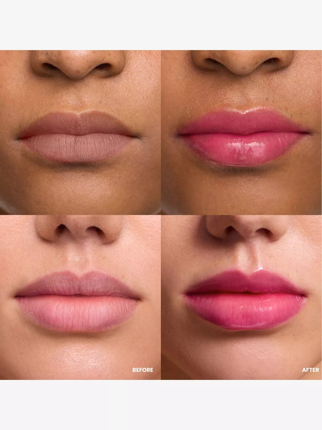 Lip Rehab Serum Oil 3.57ml - GLAM MODA