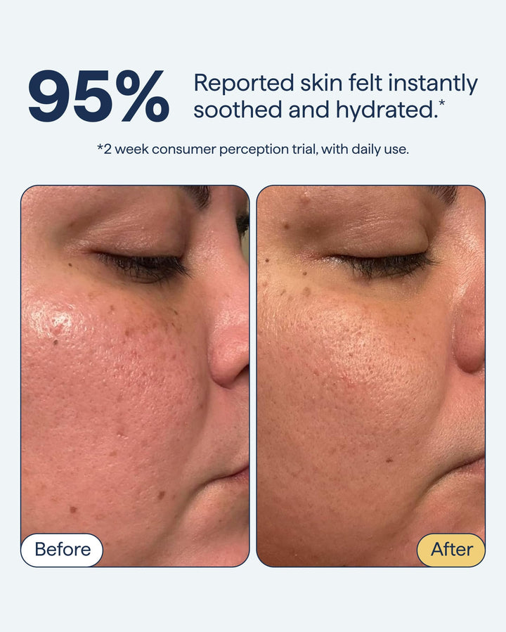 Light Gel Barrier Repairing Moisturizer - GLAM MODA