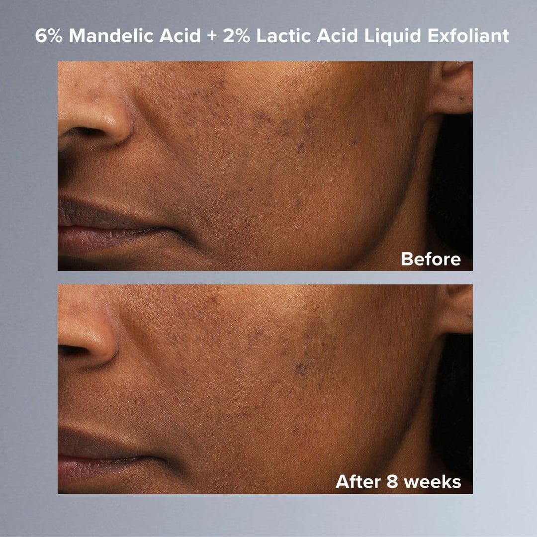 Multi-Level Exfoliation Set - GLAM MODA