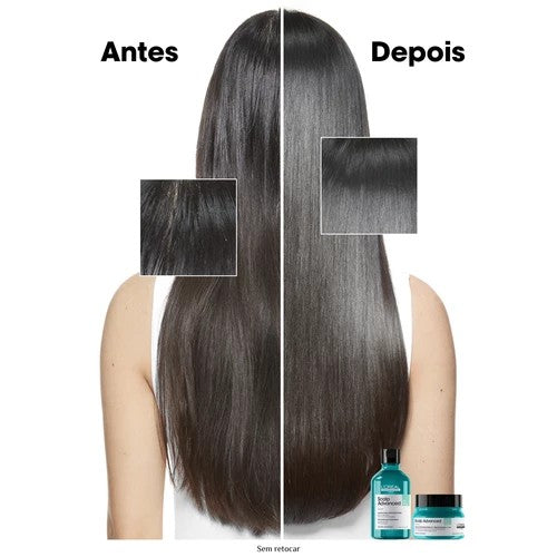 Pro Serie Expert Scalp Advance Clay 2 In 1 For Oily Hair - GLAM MODA