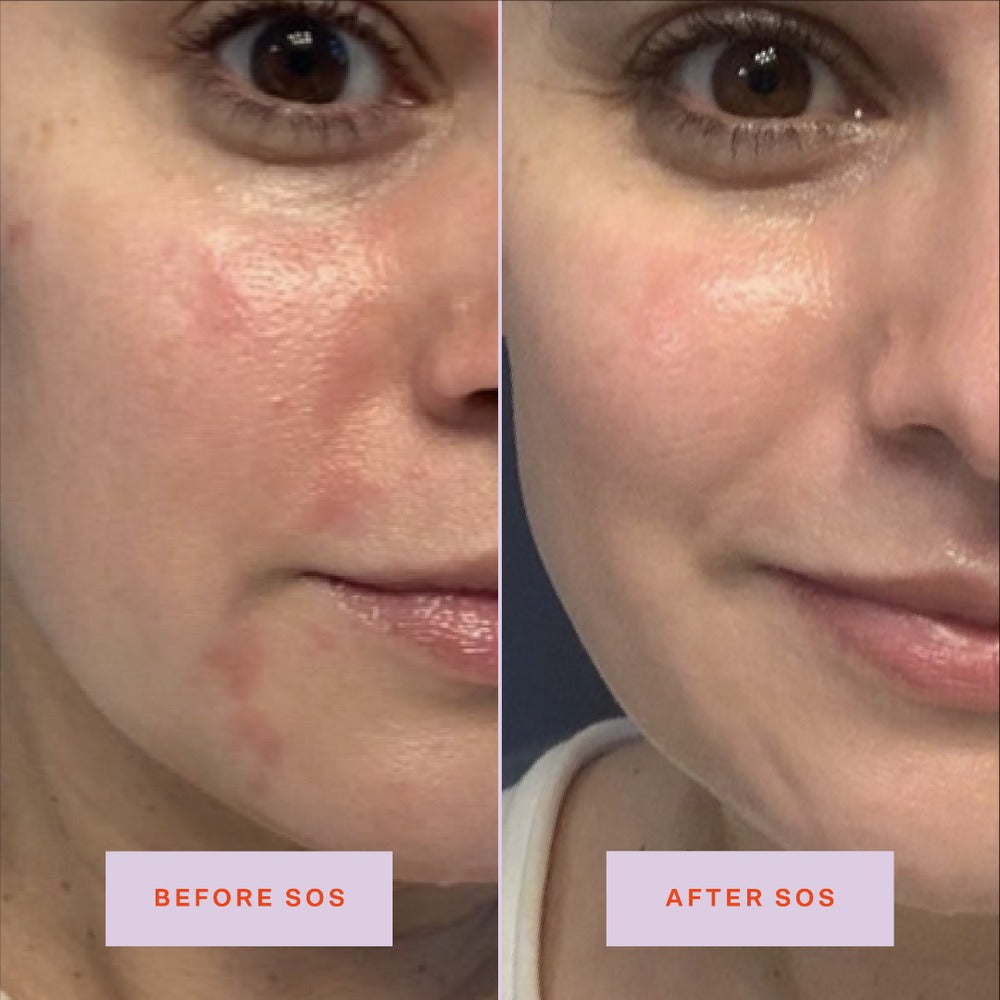 SOS Rescue Spray - GLAM MODA