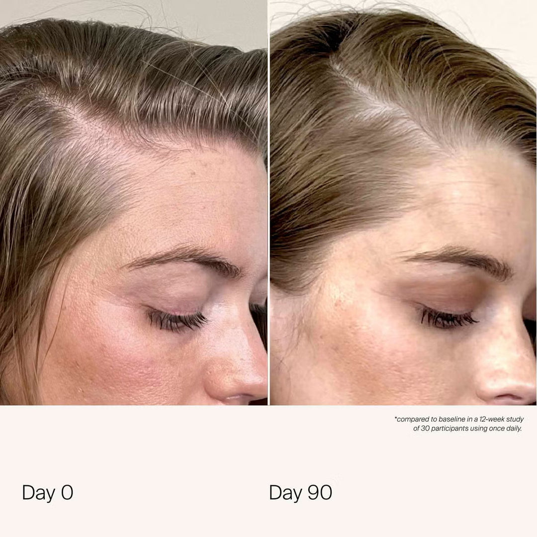 Scalp Care Density Serum - 50ml - GLAM MODA