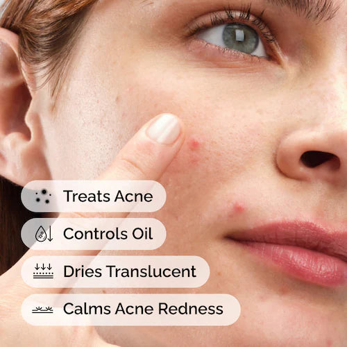 Sulfur 10% Powder-to-Cream Concentrate Acne Spot Treatment - GLAM MODA