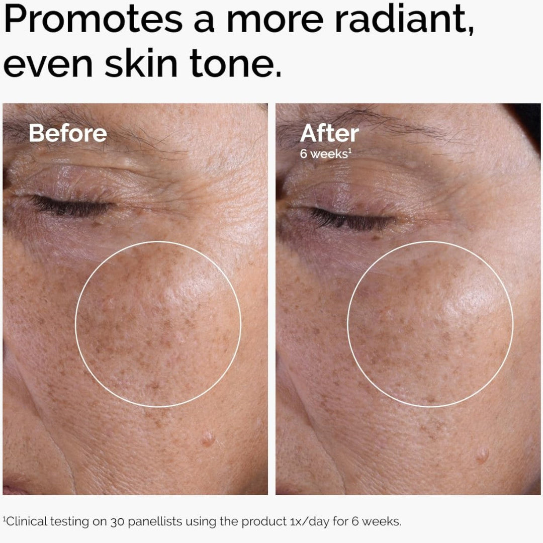 The Ordinary Glycolic Acid 7% Exfoliating Toner - GLAM MODA