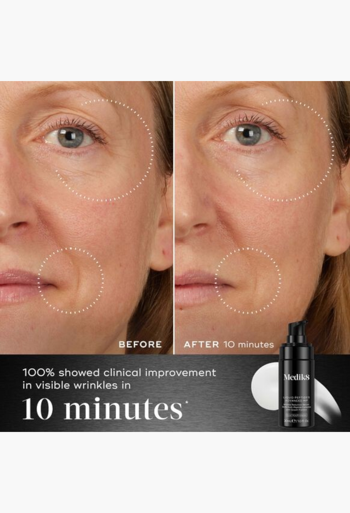 GLAM MODA Medik8 Liquid Peptides Advanced MP serum showing before and after results on skin with reduced wrinkles.