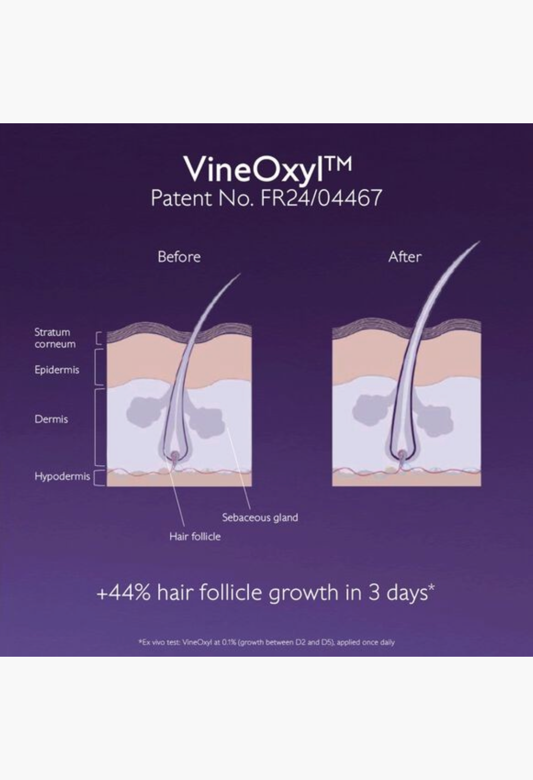 GLAM MODA scientific diagram showing hair follicle growth before and after using VineOxyl serum treatment