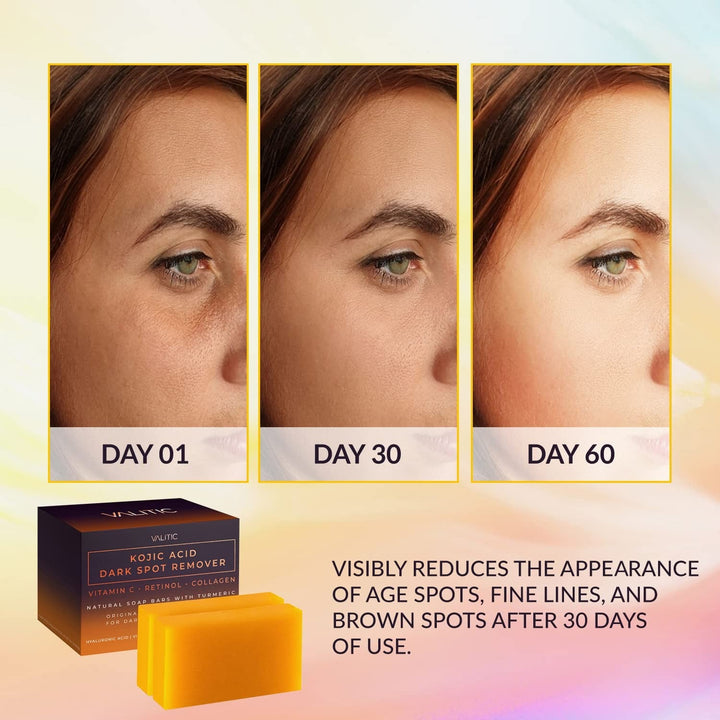 Valitic Kojic Acid Dark Spot Remover Soap Bars (2 Pack) - GLAM MODA