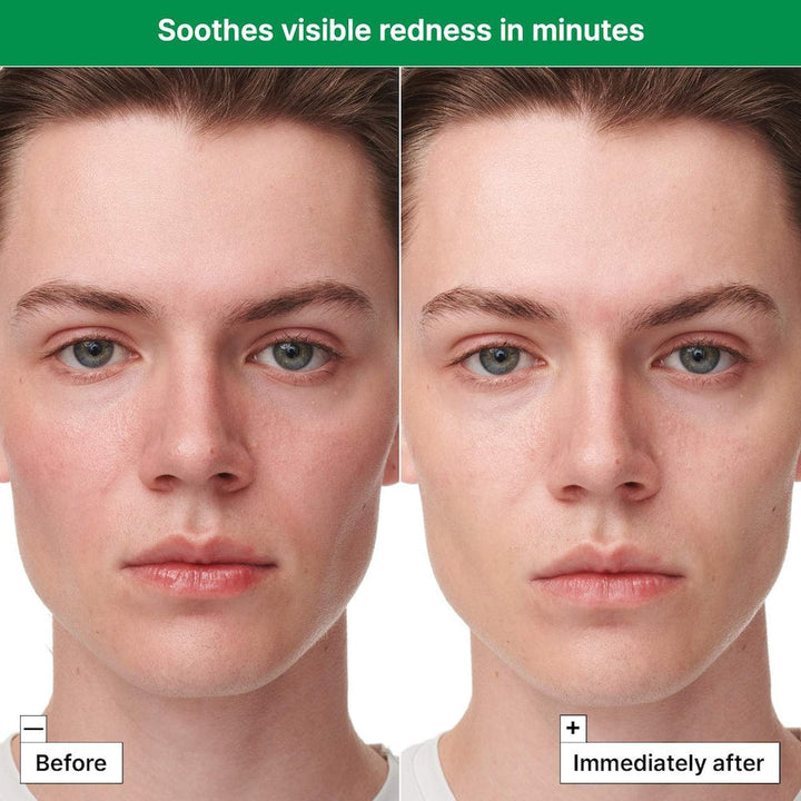 Cicapair ™ Sensitive Skin Serum Face Mask for Redness - GLAM MODA