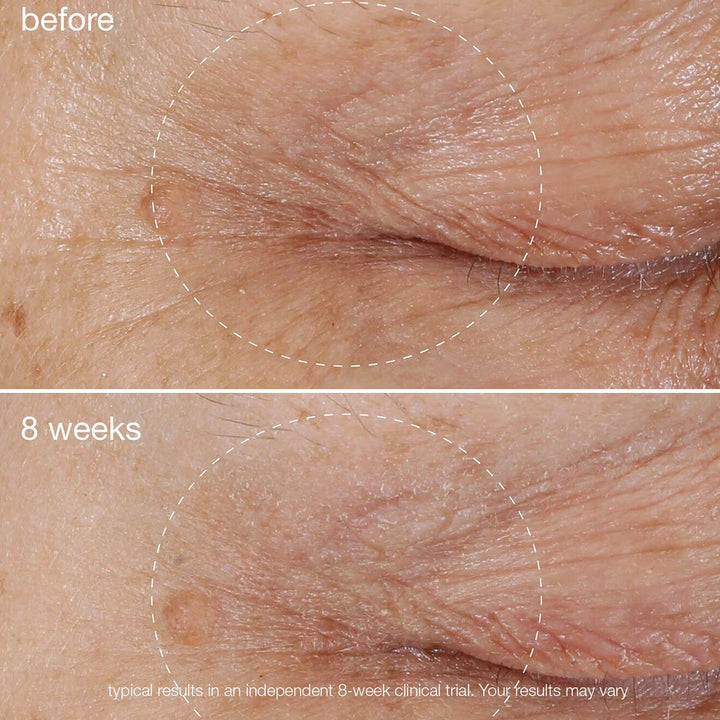 Biolumin-C Vitamin C Eye Serum - GLAM MODA