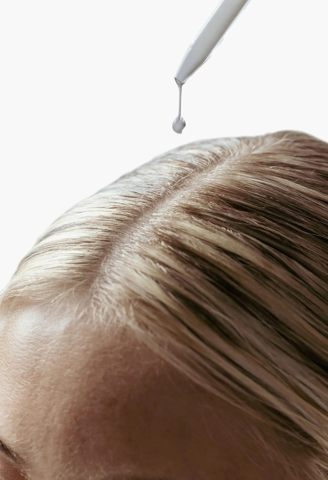 Fresh Start Anti-Dandruff Scalp Serum - GLAM MODA