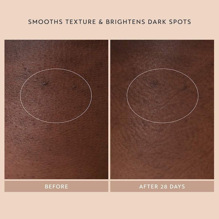 Body Reform Treatment Serum with 2% Granactive Retinoid - GLAM MODA