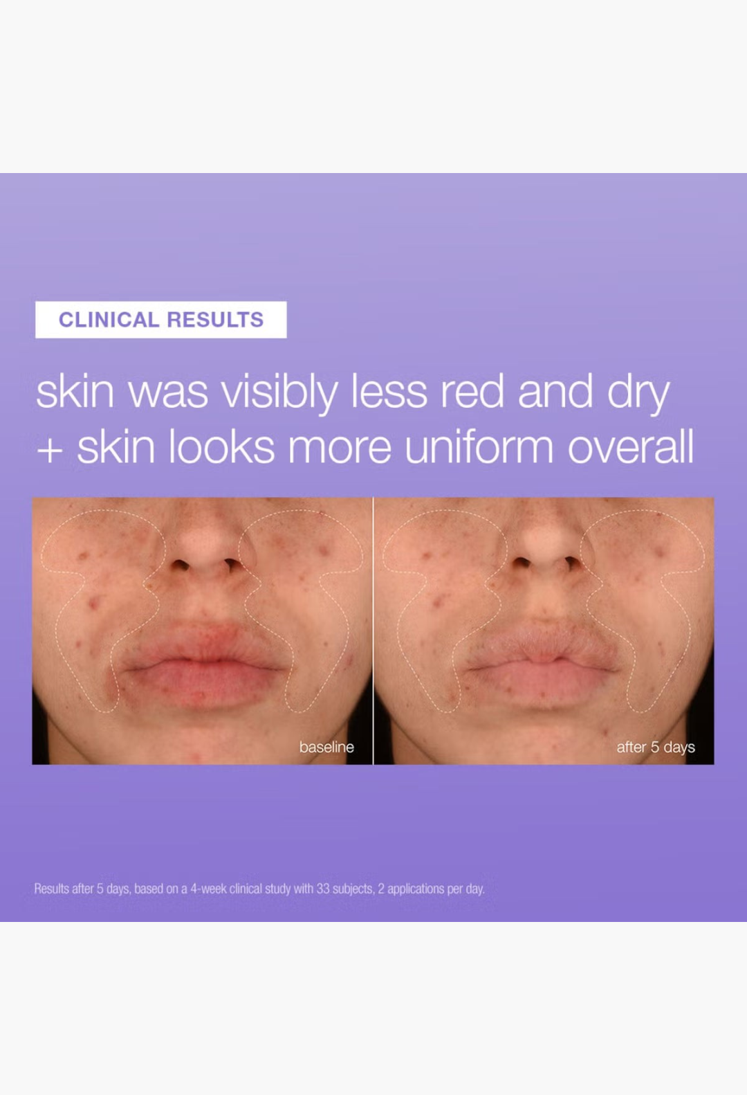 GLAM MODA clinical results showing reduced redness and improved skin uniformity after using Dermalogica repair serum