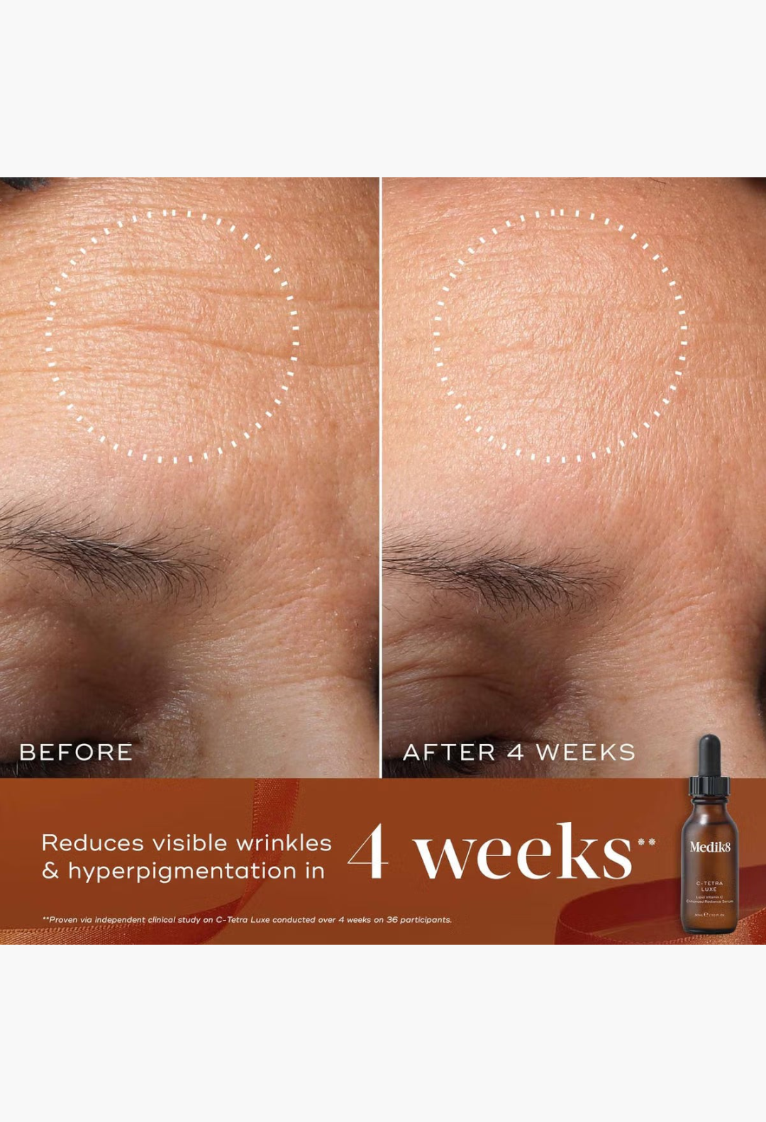 GLAM MODA Medik8 Radiance Ritual before and after results showing skin texture improvement with C-Tetra Luxe serum