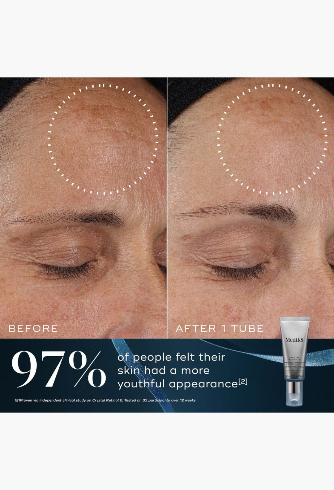 GLAM MODA Medik8 Crystal Retinal before and after results showing reduced fine lines and improved skin texture