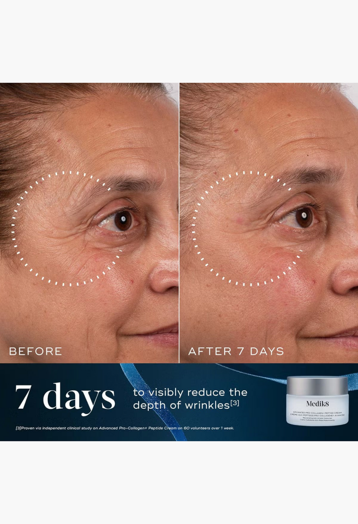 GLAM MODA Medik8 Age-Defying Essentials before and after results showing reduced fine lines around the eye area