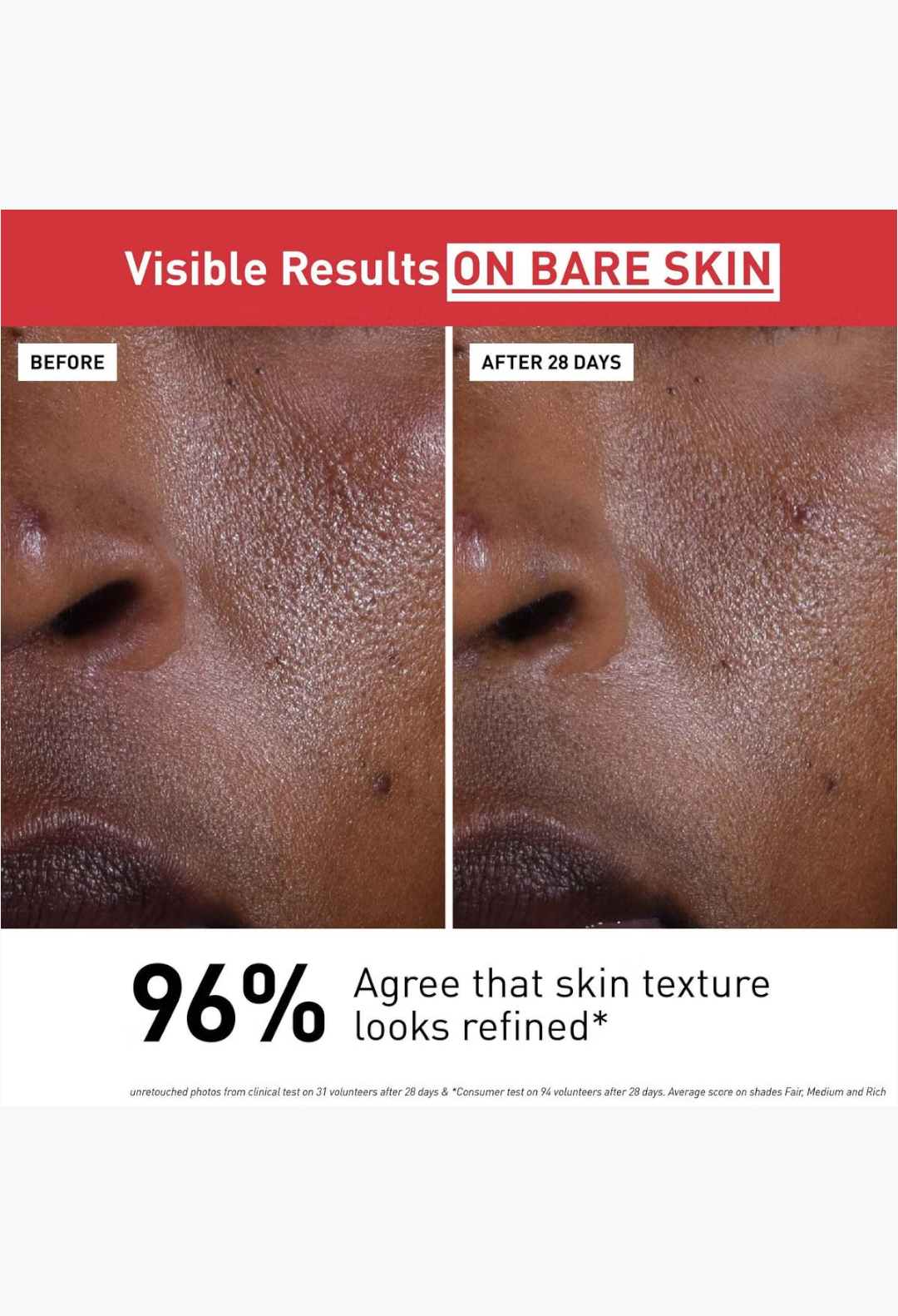 GLAM MODA before and after comparison of skin texture improvement using Erborian CC Cream with Centella Asiatica