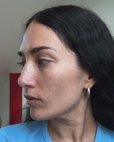 Pore Refining Complex Serum