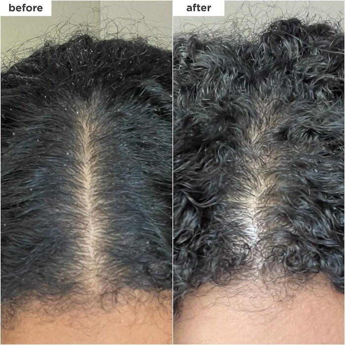 Scalp Revival Charcoal + Coconut Oil Micro-exfoliating Scalp Scrub Shampoo - GLAM MODA