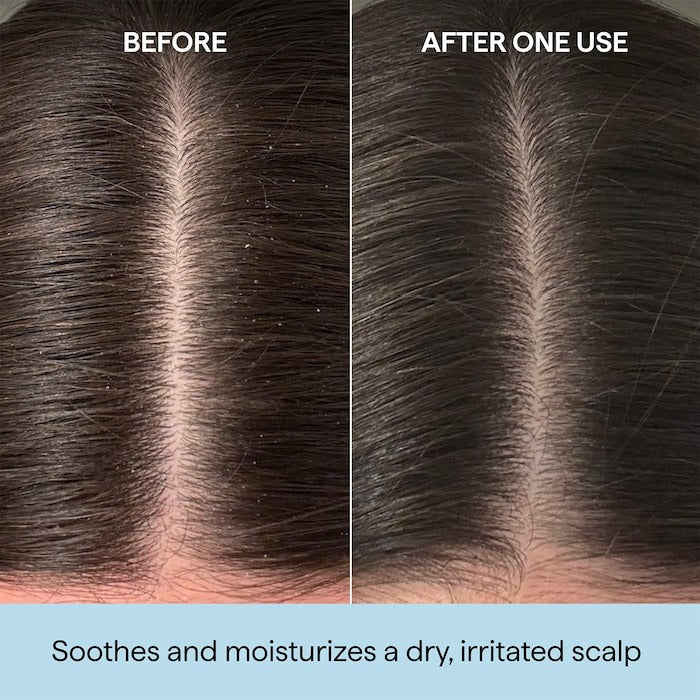 Scalp Revival™ Rosemary Pre-Wash Scalp and Hair Oil - GLAM MODA