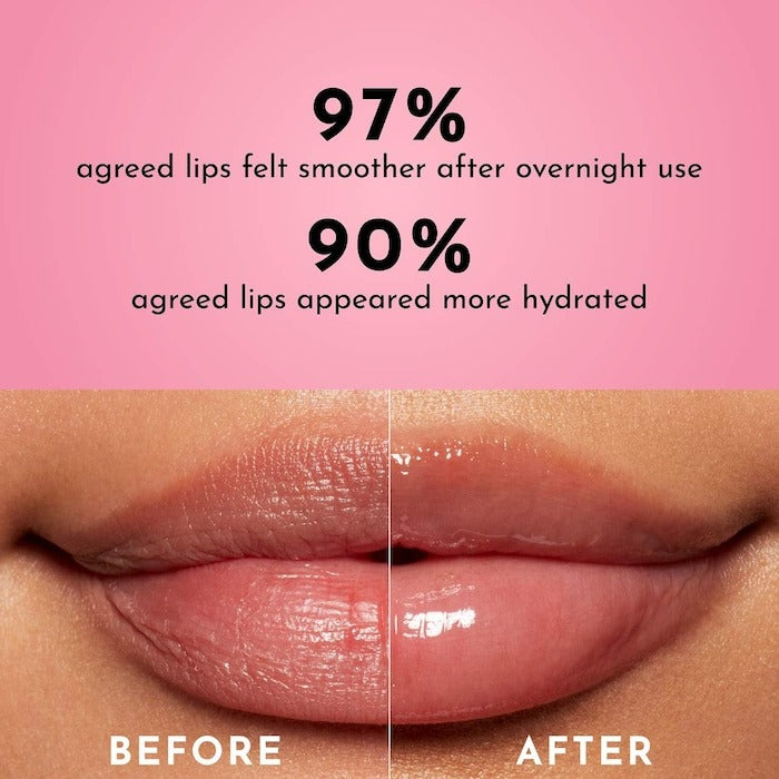 Forget The Filler Overnight Lip Plumping Mask - GLAM MODA