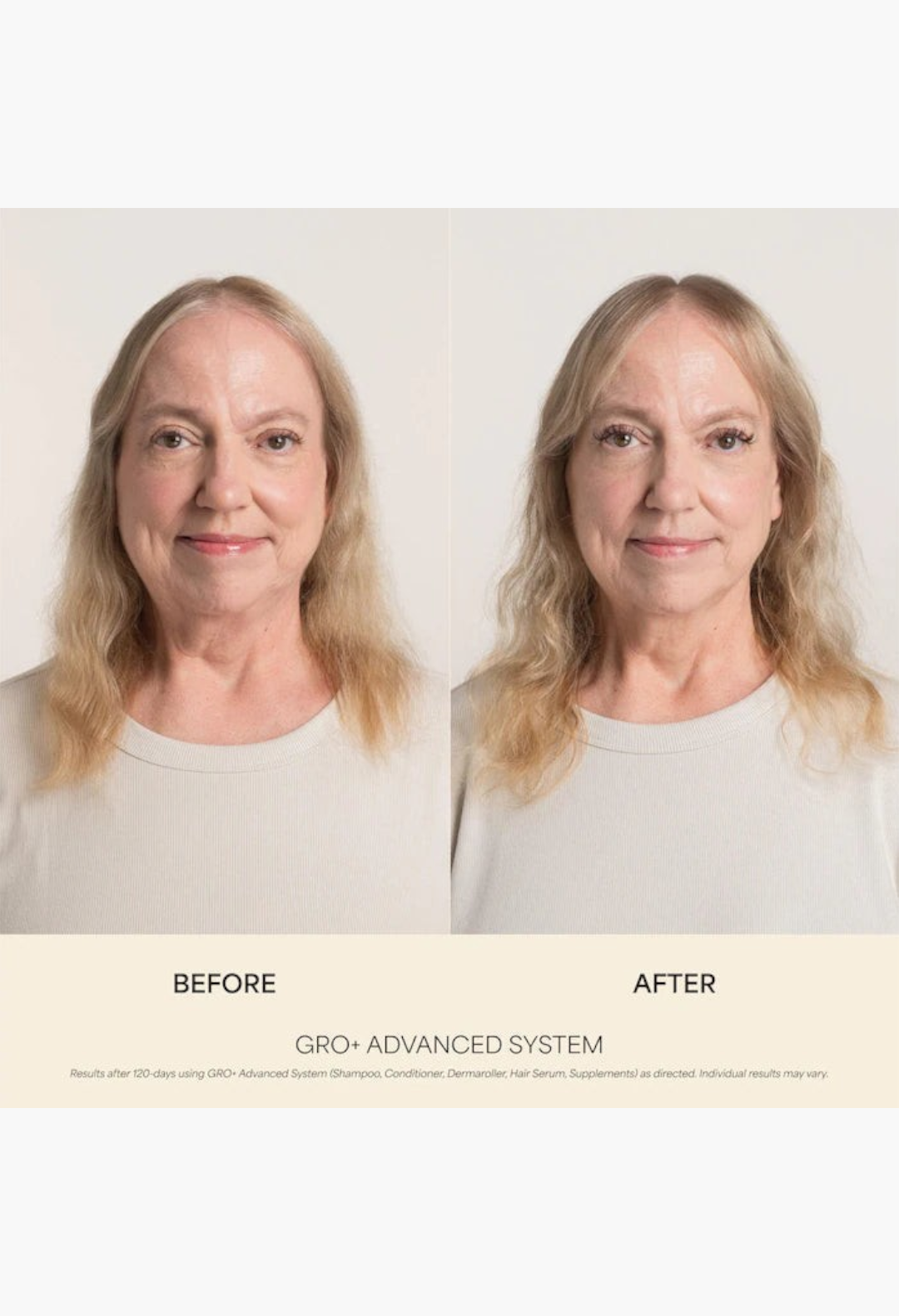 GLAM MODA before and after comparison of a woman showing hair volume improvement using GRO+ Advanced hair care system.