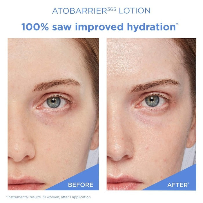 Atobarrier365 Lightweight Face Lotion Moisturizer With Ceramides & Niacinamide For Skin Moisture Barrier Repair - GLAM MODA