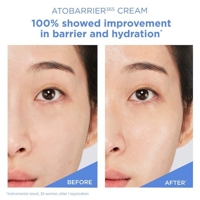 Atobarrier365 Cream Moisturizer With Ceramides & Niacinamide For Skin Moisture Barrier Repair - GLAM MODA