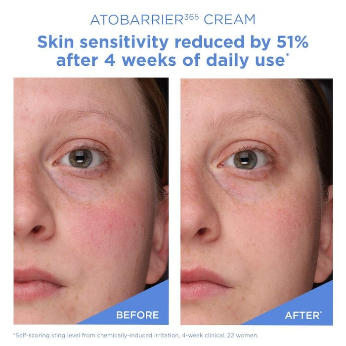 Atobarrier365 Cream Moisturizer With Ceramides & Niacinamide For Skin Moisture Barrier Repair - GLAM MODA