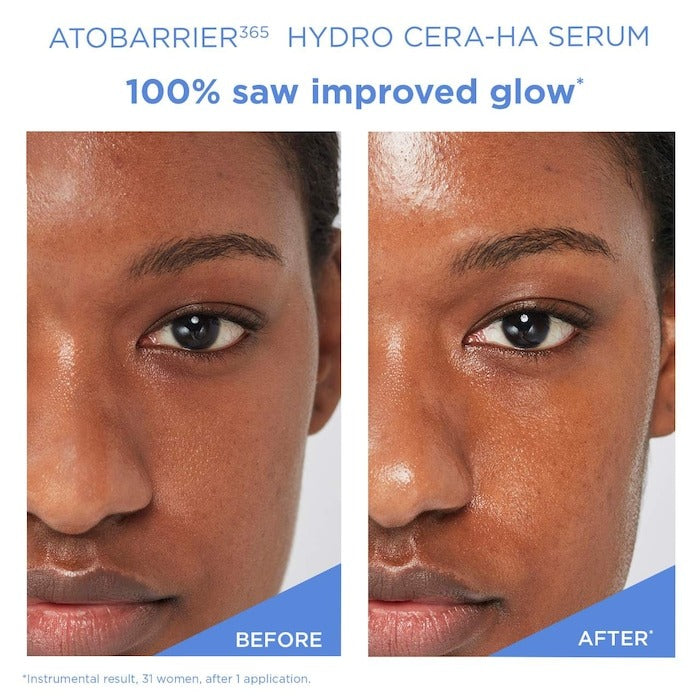 Atobarrier365 Hydro Cera-Ha Ceramide + Hyaluronic Acid Face Serum For Skin Moisture Barrier Repair - GLAM MODA