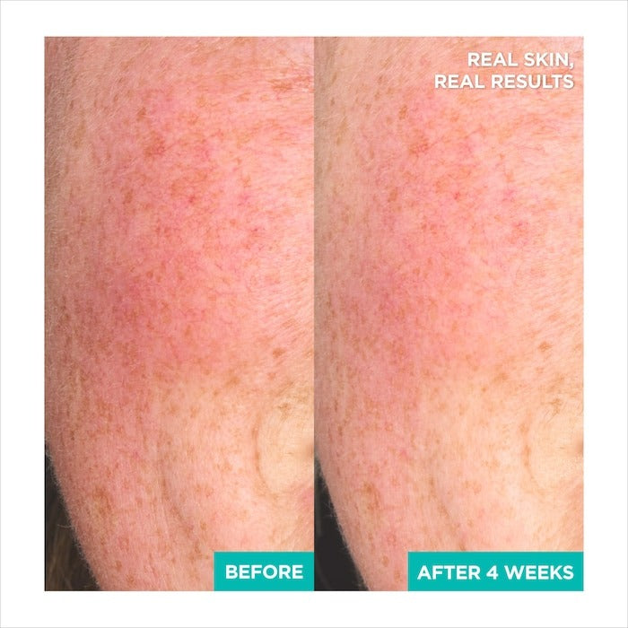 A-Cica365 Soothing Redness Relief Face Serum Ph4.5 With Centella Asiatica + Hyaluronic - GLAM MODA